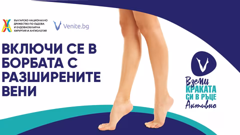 Безплатни прегледи за разширени вени във Враца на 18 и 25 юни